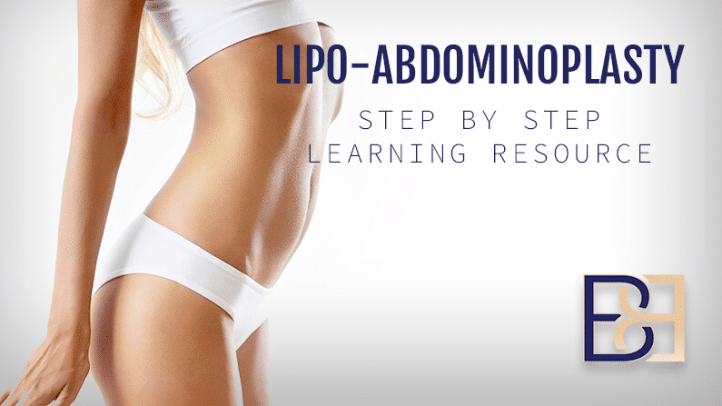 How do I Perform Lipo Abdominoplasty