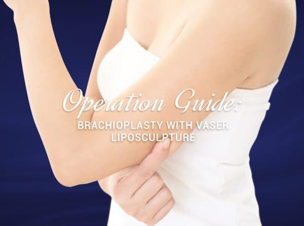 Operation Guide: Brachioplasty with VASER Liposculpture