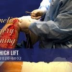 Patient 2020-6002 - Cosmetic_Surgery_Training - Inner Thigh Lift