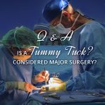 Is a tummy tuck considered major surgery