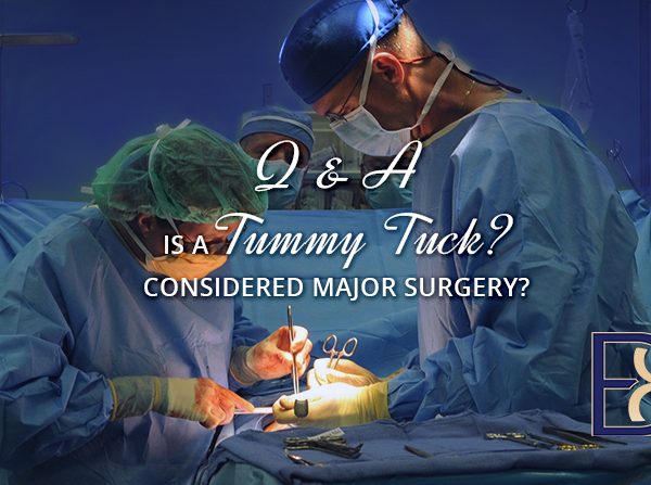 Is a tummy tuck considered major surgery