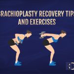 Arm Exercises to Maintain Your Brachioplasty Results