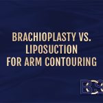 Brachioplasty vs. liposuction for arm contouring