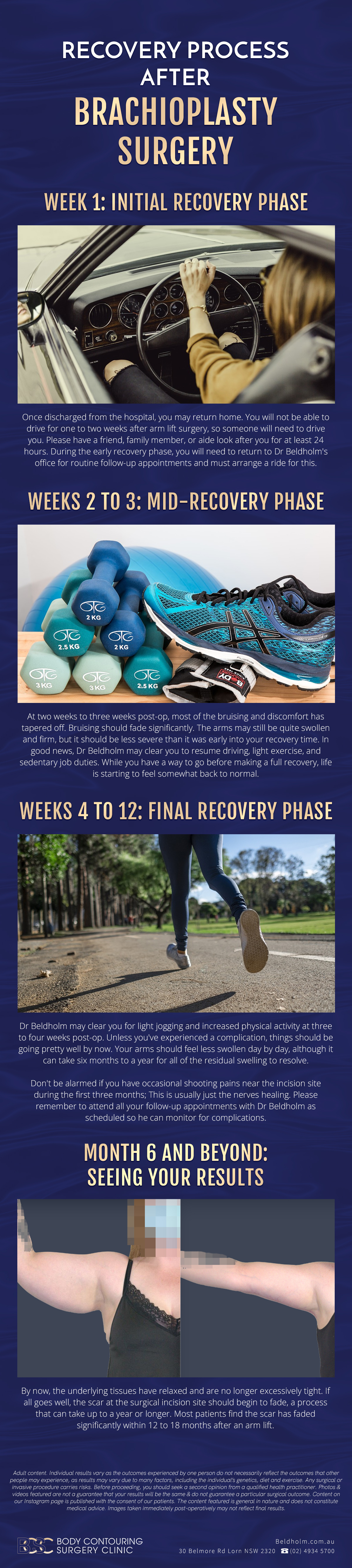 Recovery process after brachioplasty surgery - Infographic