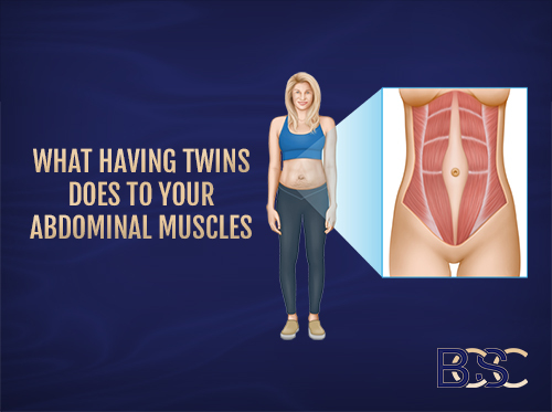What Having Twins Does to Your Abdominal Muscles