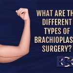 What are the Different Types of Brachioplasty Surgery