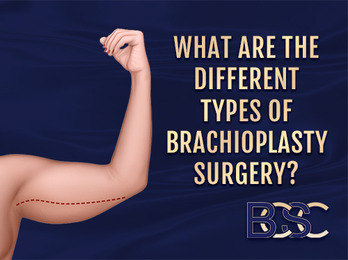What are the Different Types of Brachioplasty Surgery