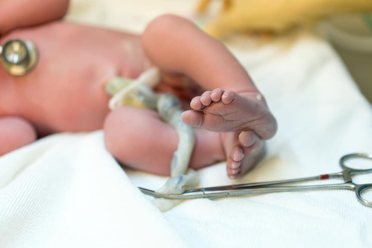 Baby with umbilical cord clamped