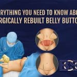 Everything You Need to Know about Surgically Rebuilt Belly Buttons