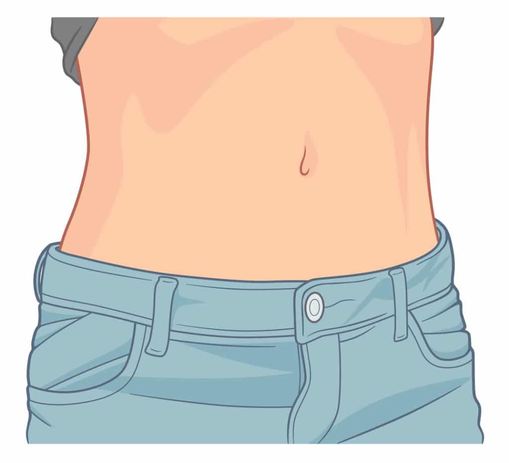 What is Umbilicus Reconstruction Surgery