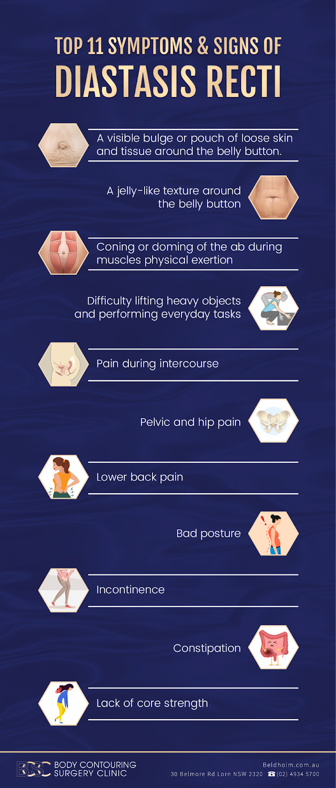 Symptoms of Diastasis Recti (abdominal muscle separation)