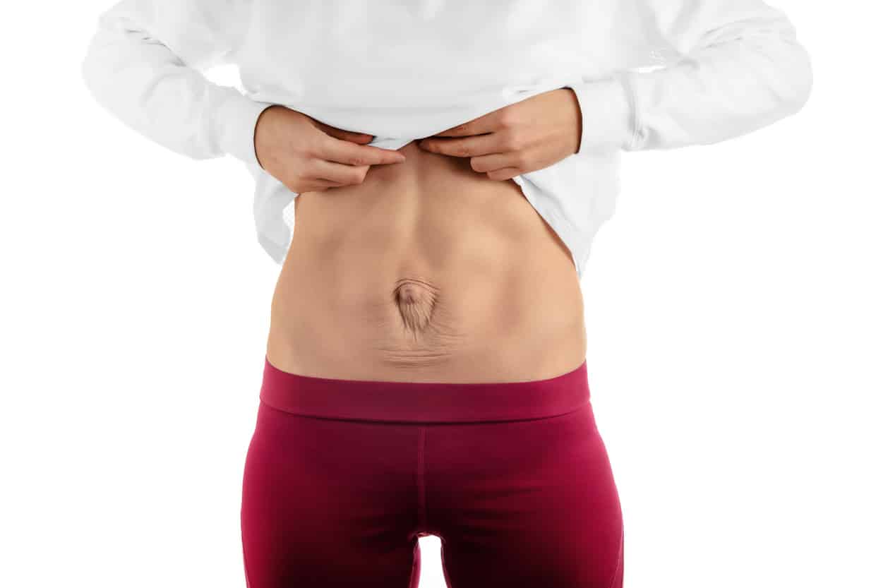 How to Tell if Your Abdominal Muscles Were Torn During Pregnancy