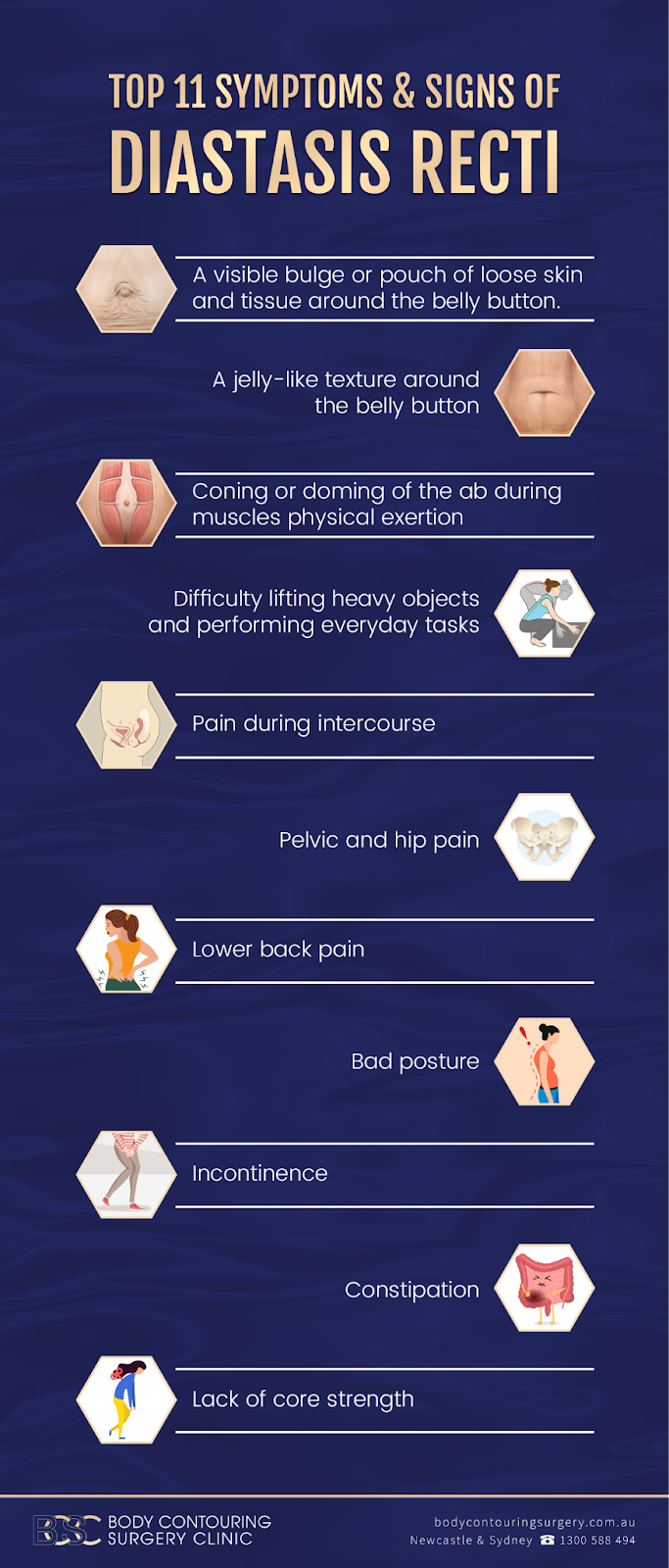 Infographic of top 11 symptoms of diastasis recti