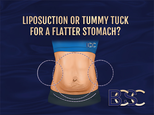 Abdominoplasty or Liposuction: What’s Better For Getting a flat tummy?