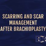 Arm Lift Scars: What to Expect and Tips for Scar Healing
