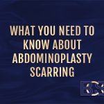 What You Need to Know About Tummy Tuck Scarring