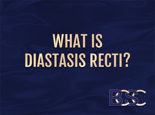Everything You Need to Know about Diastasis Recti