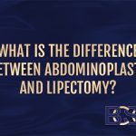 Abdominoplasty Vs. Lipectomy