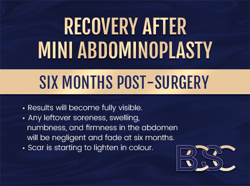 Infographic - Six months after mini tummy tuck surgery