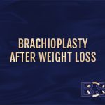 Brachioplasty after weight loss