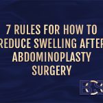 7 Rules for How to Reduce Swelling After Tummy Tuck Surgery
