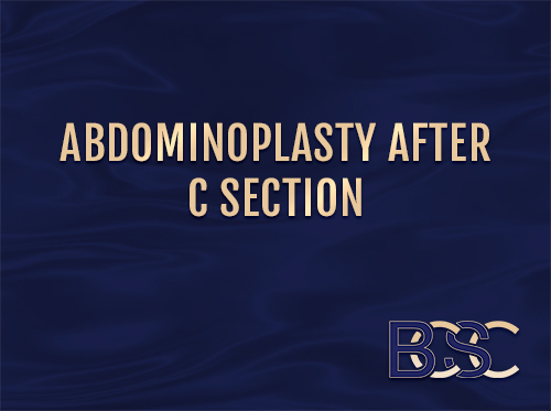 Abdominoplasty After C-Section