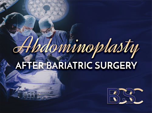 Abdominoplasty After Bariatric Surgery