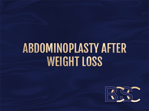 Abdominoplasty After Weight Loss