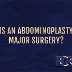 Is An Abdominoplasty Major Surgery?