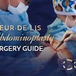 Fleur-de-Lis Abdominoplasty Surgery Guide