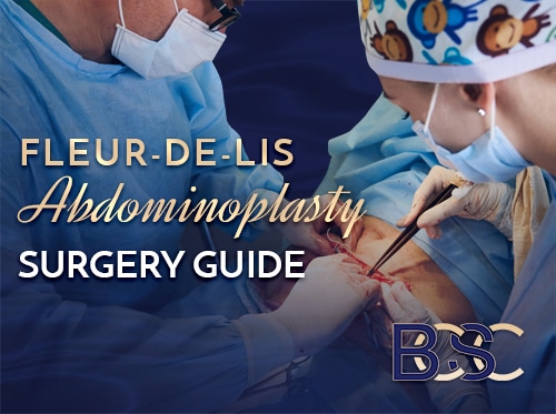 Fleur-de-Lis Abdominoplasty Surgery Guide