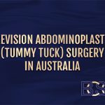 Revision Abdominoplasty (Tummy Tuck) Surgery in Australia