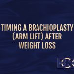 Timing a Brachioplasty (Arm Lift) After Weight Loss
