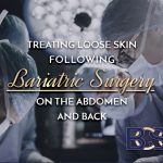 Treating Loose Skin Following Bariatric Surgery on the Abdomen and Back
