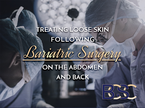 Treating Loose Skin Following Bariatric Surgery on the Abdomen and Back