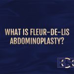 What is Fleur-de-Lis Abdominoplasty?