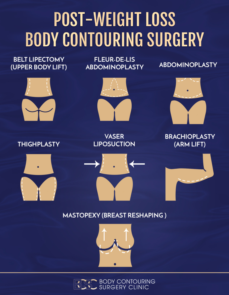 Post Weight Loss Body Contouring Surgery