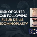 Risk of Outer Scar Following Fleur-de-Lis Surgery (Tummy Tuck)