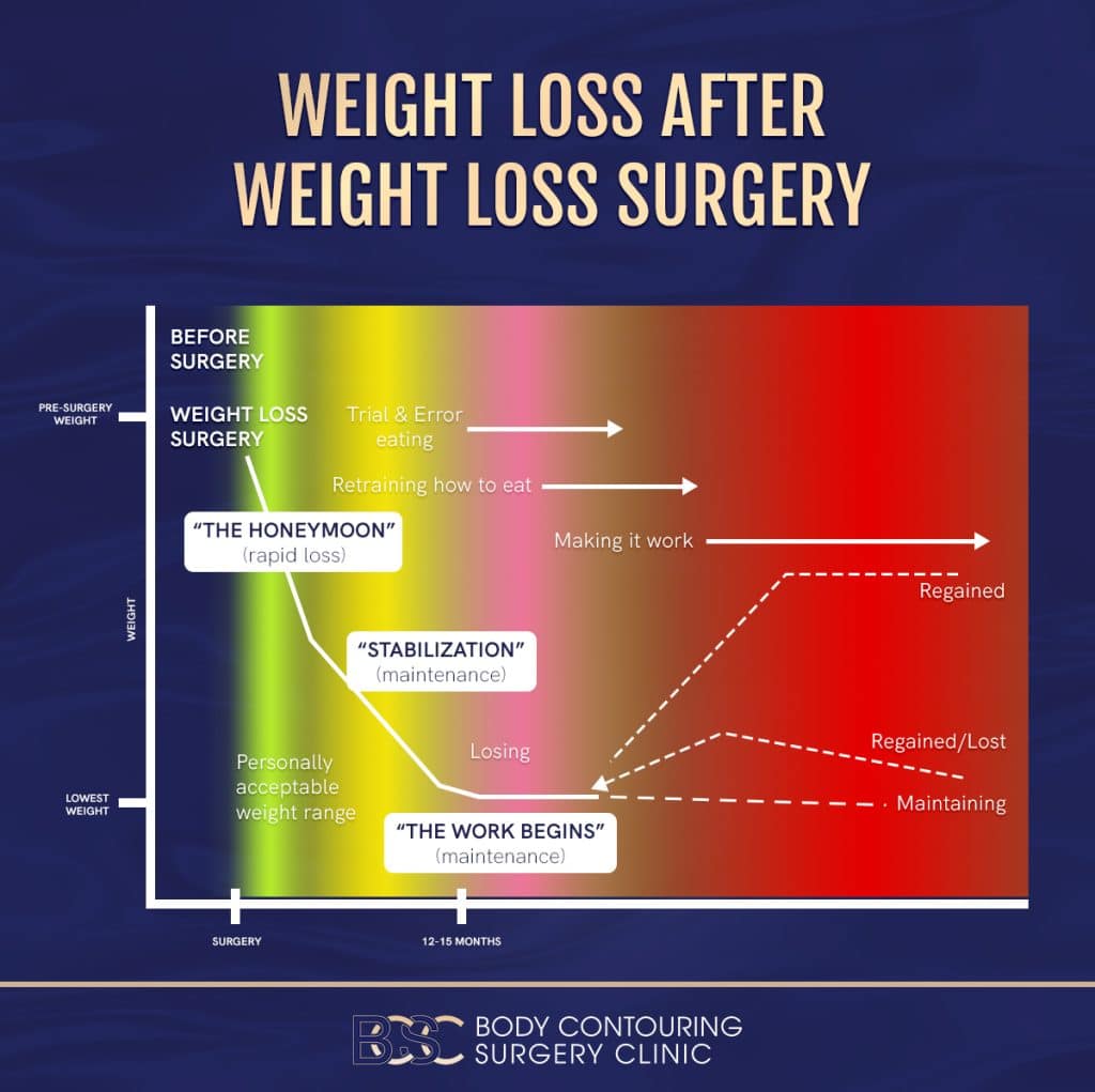 Weight loss after weightloss surgery Infographic