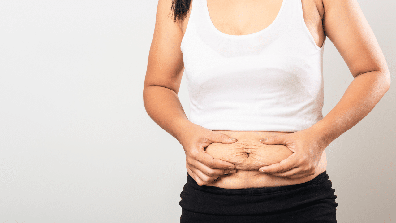 excess skin and fat after  significant weight loss