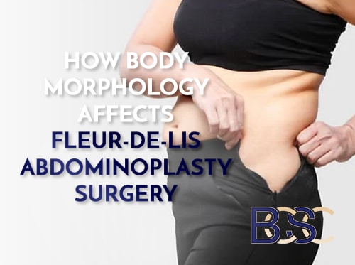 How Significant Changes in the Body’s Morphology (Biology) Affects Fleur-de-Lis Abdominoplasty Surgery