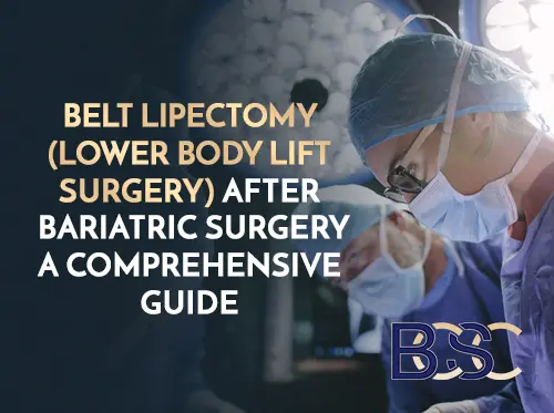 Belt Lipectomy (Lower Body Lift Surgery) After Bariatric Surgery: A Comprehensive Guide