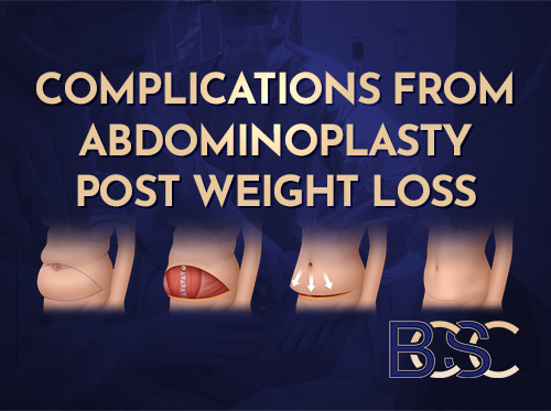 Overview of Abdominoplasty After Weight Loss