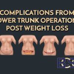 Complications from Lower Trunk Operations Post Weight Loss