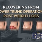 Recovering from Lower Trunk Operations Post Weight Loss