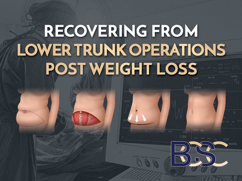 Recovering from Lower Trunk Operations Post Weight Loss