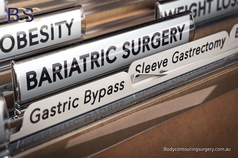 Timing After Bariatric Surgery - BCSC