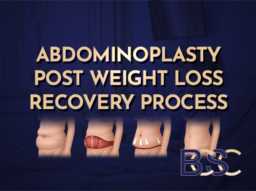 Abdominoplasty Post Weight Loss Recovery Process (Standard and Extended Abdominoplasty)