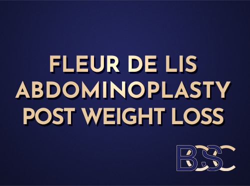 Post Weight Loss Fleur-de-Lis Abdominoplasty