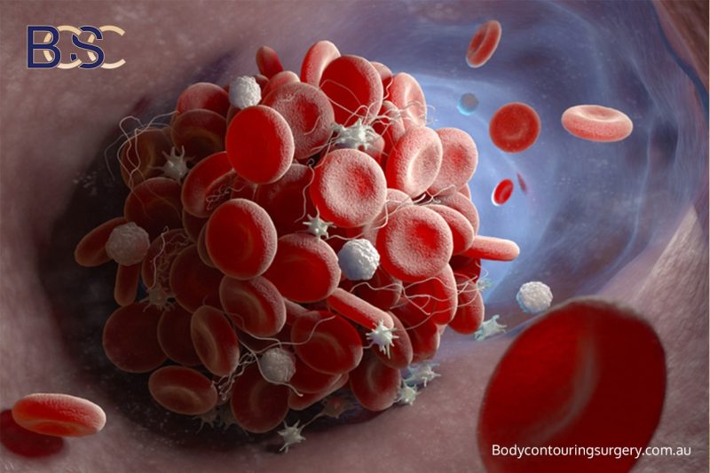 Safety concerns - Blood clot